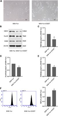 Verapamil Alleviates Myocardial Ischemia/Reperfusion Injury by Attenuating Oxidative Stress via Activation of SIRT1